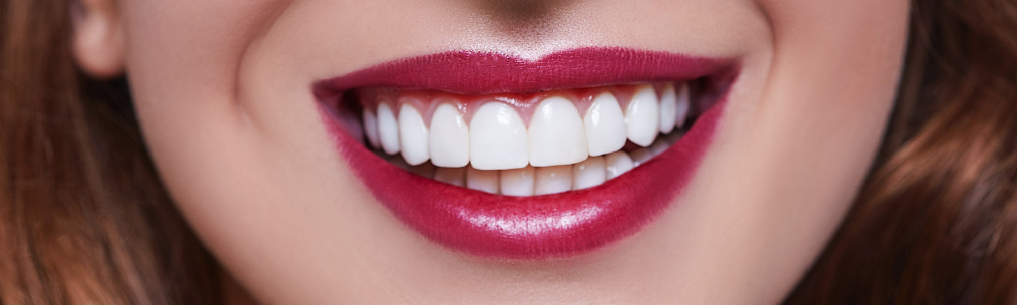 Wishing for a Straighter Smile? Why It’s About More Than Just Aesthetics Blog Image