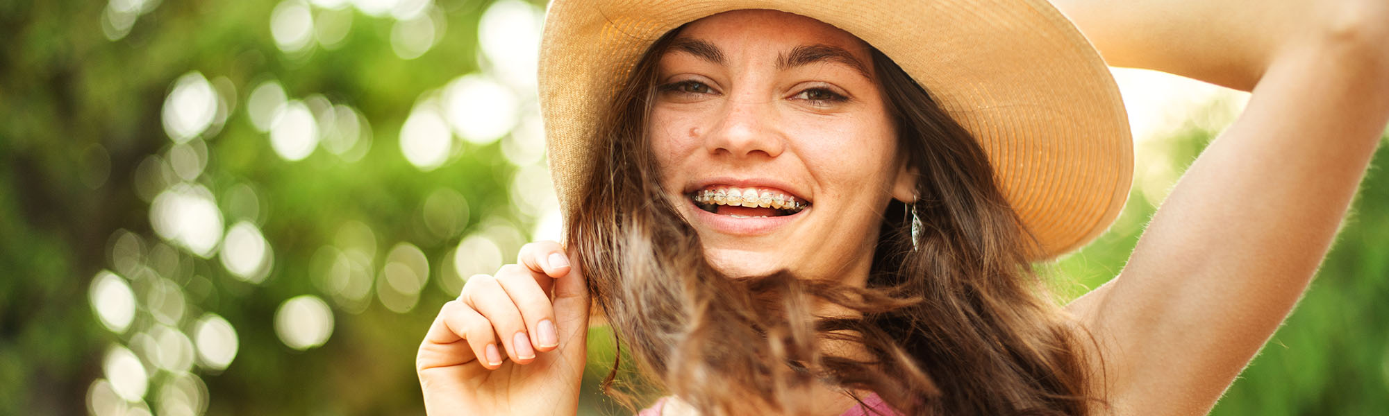 Braces on vacation Carson CA