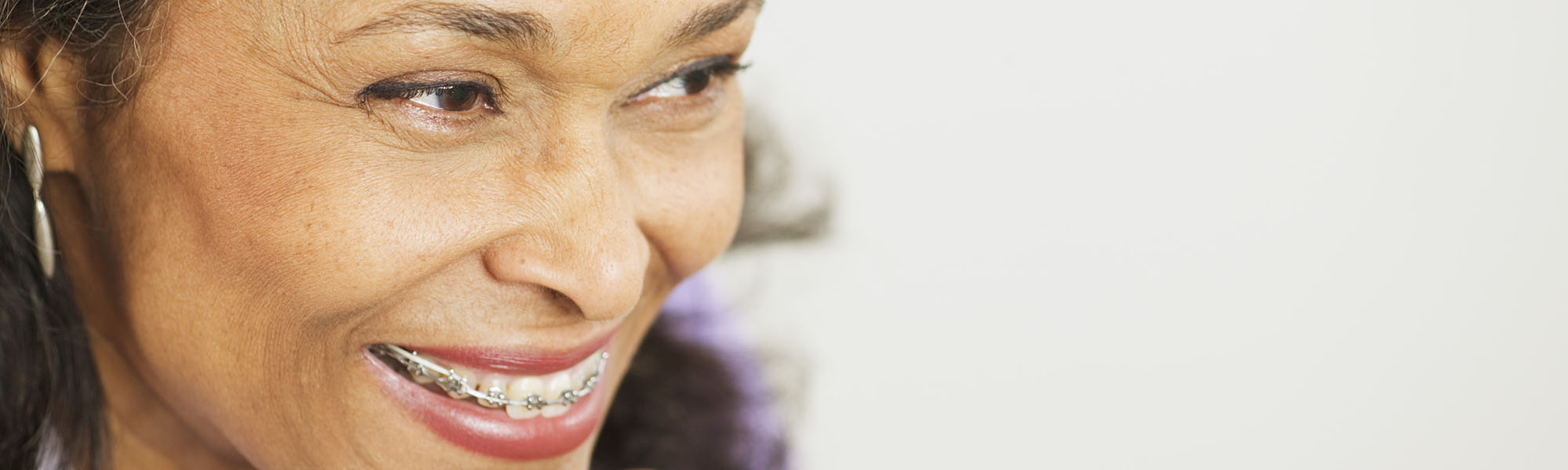 Is It Ever Too Late for Orthodontic Treatment? A Look at Braces for Seniors