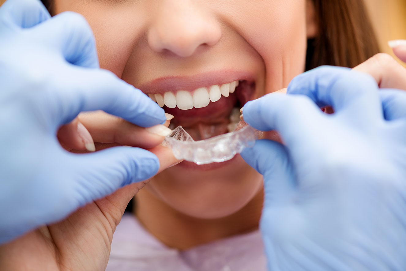 Orthodontist Near Me Carson CA