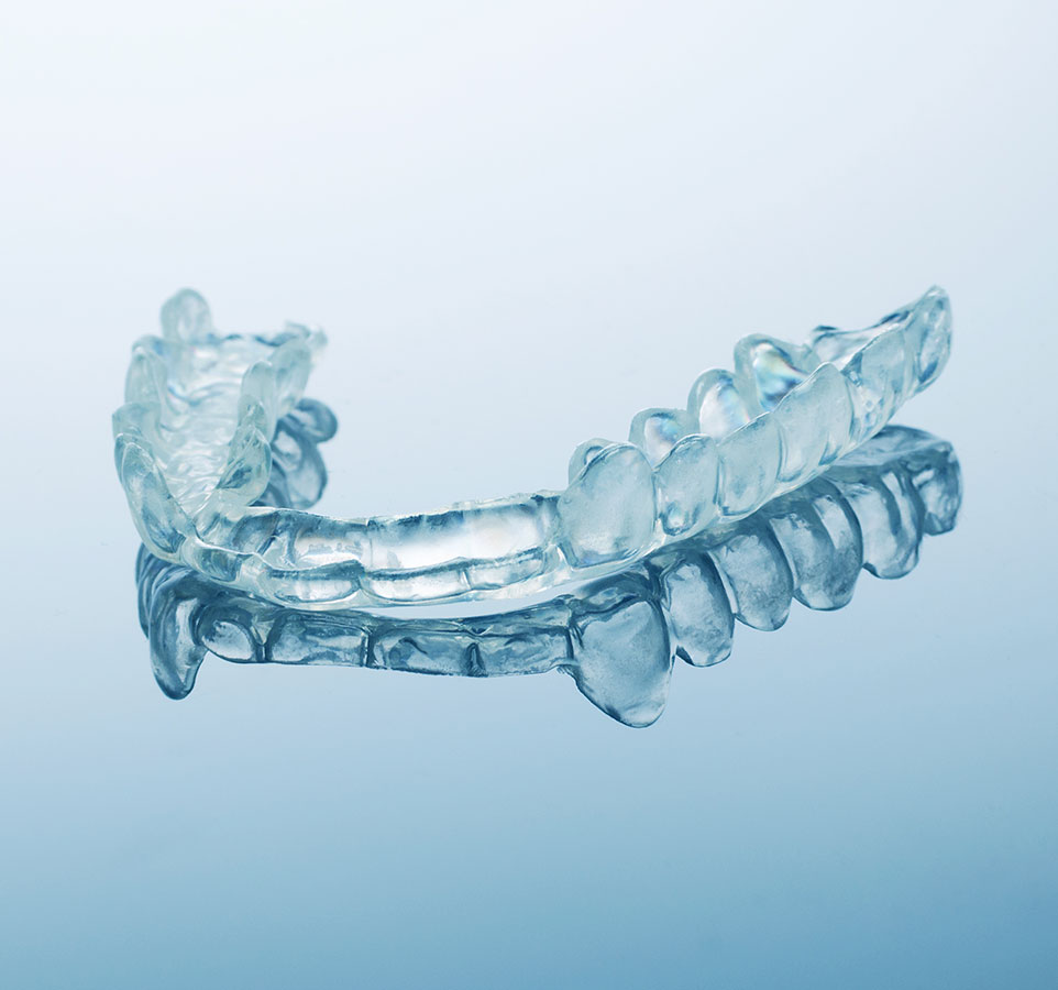 Invisible Braces Carson CA