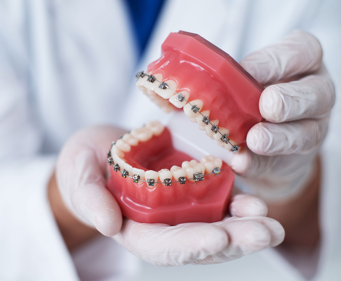 Metal Braces Carson CA